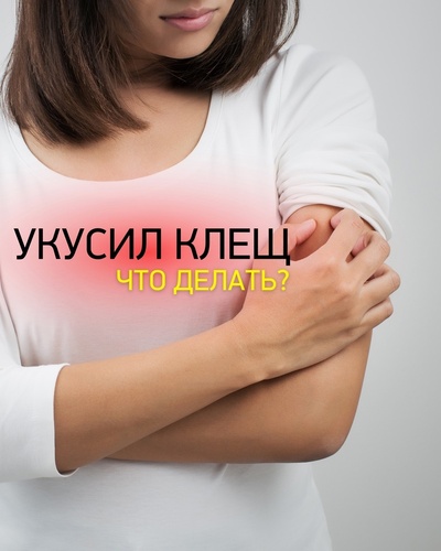 Клещ укусил — что делать? Инструкция для родителей.