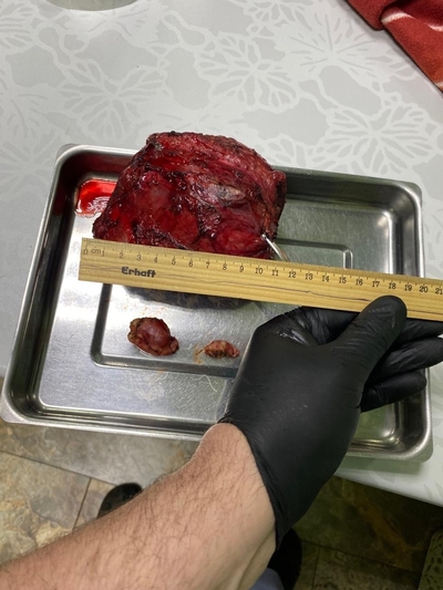 Онкологические пациенты: как мы помогаем им справиться с болезнью.