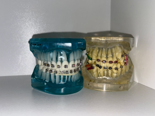 Думаете об идеальной улыбке? Брекеты - надёжный путь к ровным зубам и здоровому прикусу!