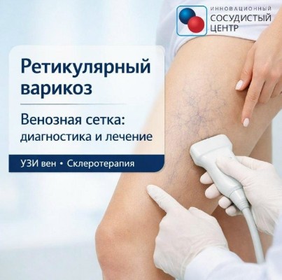 Сеточка на ногах? Это ретикулярный варикоз!